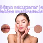 Recuperar los labios maltratados con Línea Estética